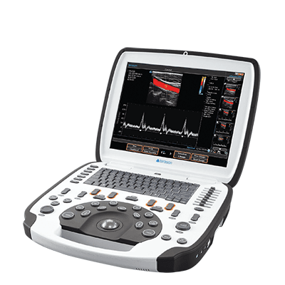 Das tragbare Ultraschallgerät uSmart 3300