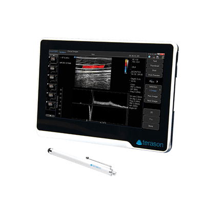 Ultraschallgerät tragbar uSmart 3200T