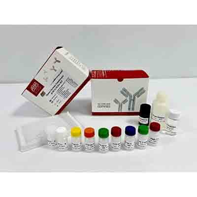 Quick Enzymatic Immunoassay Kit ß-HCG