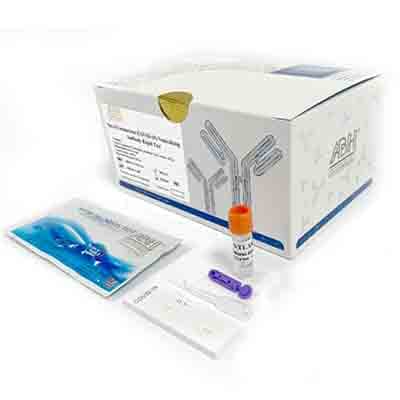 Rapid antibody neutralization test kit for coronavirus